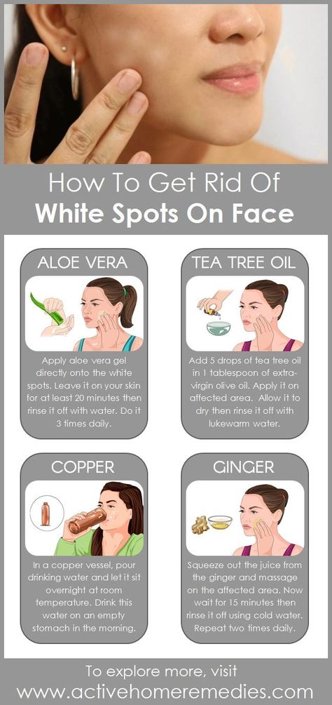 White Spots On Face, White Spots On Skin, Spots On Skin, Brown Age Spots, Face Home, Brown Spots On Face, Skin Spots, Spots On Face, Beauty Tips For Face