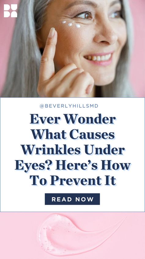 Wrinkles Under Eyes, Natural Wrinkle Remedies, What Causes Wrinkles, Leo Tattoo, Anti Aging Remedies, Homemade Wrinkle Cream, Lotion For Oily Skin, Eye Wrinkles, Wrinkle Remedies