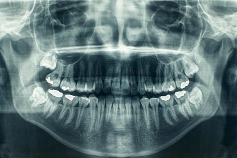 Noah Core, What Is Stem, Cord Blood Banking, Loose Tooth, Health Unit, The Teeth, Tooth Sensitivity, Dental Services, Dental Practice