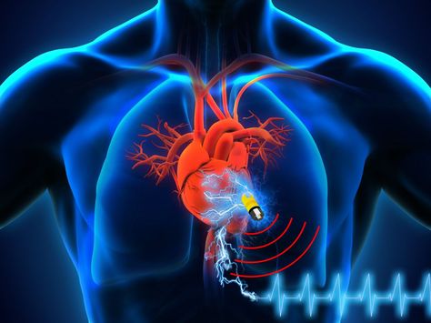 Battery-free implantable #medicaldevice draws energy directly from human body Heart Facts, Cardiac Rhythms, Reduce High Blood Pressure, Diagram Design Ideas, Heart Place, Creepy Places, Regenerative Medicine, Vagus Nerve, Diagram Design