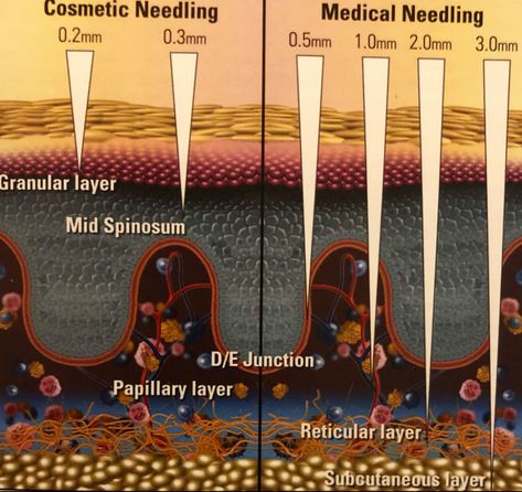 Microneedling Depth Chart, Microneedling Video, Microneedling After Care, Microneedling Before And After, Microneedling Aesthetic, Microneedling At Home, Microneedling Serum, Dermapen Microneedling, Skin Facts