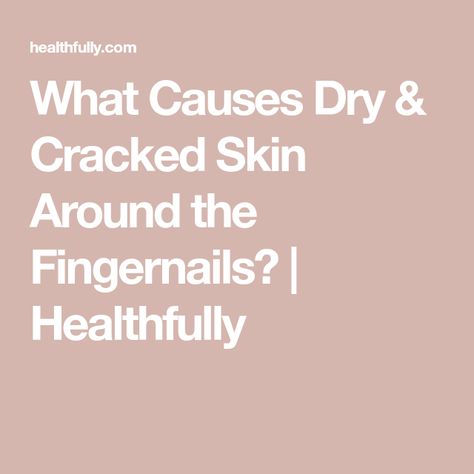 Cracked Fingertips, Cracked Fingers, Crusty Skin, Cracked Nails, Dry Cuticles, Ways To Heal, Cracked Hands, Dry Skin On Face, Extra Dry Skin