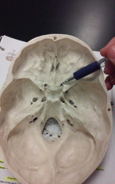 Optic canal Anatomy Art, Ice Cream, Cream