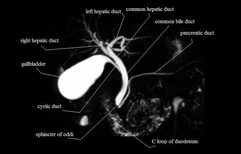 Mri Study Guide, Biliary System, Mri Anatomy, Mri Technologist, Medical Radiography, Mri Tech, Mri Brain, Radiology Student, Radiology Technician