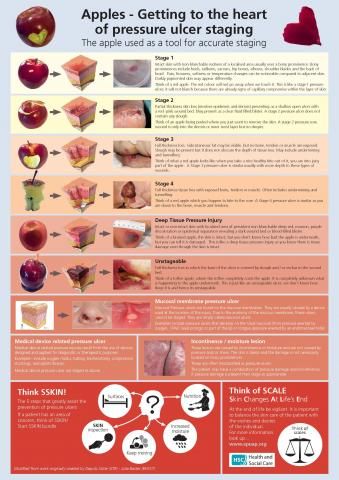 Pressure Ulcer Prevention, Pressure Ulcer Staging, Heart Pressure, Pressure Ulcer, Head Pain, Care Home, Belfast, Public Health, Staging