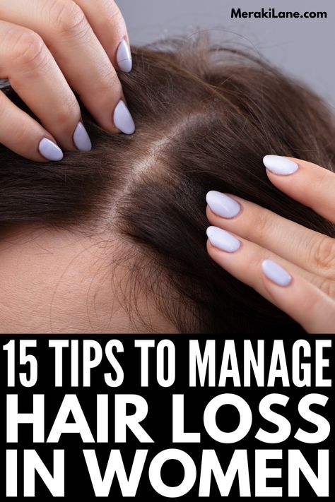 Female Hair Thinning, How To Fix Hairline Women, What To Do About Thinning Hair, Hairloss Remedy Woman, Hair Thinning Remedies Woman Sephora, Excess Hair, Brown Spots On Face, Hair Control, Bald Women