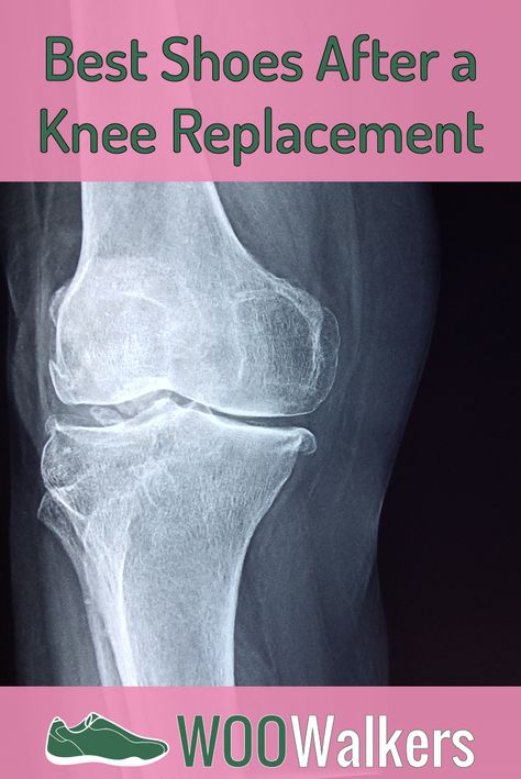 So, you’ve decided to take the step towards a painless life and undergo a full knee replacement surgery. As someone whose partner had the surgery before, I can tell you that you’re making an excellent decision. After it’s all said and done, you’ll be wondering why you didn’t do it sooner in the first place. However, there’s more to the recovery from a knee replacement surgery than just rest. Pt For Knee Replacement, Full Knee Replacement Recovery, Exercise For Knee Replacement, Exercises Before Knee Replacement, Exercise After Knee Replacement, Preparing For Knee Replacement Surgery, Exercises After Knee Replacement Surgery, Knee Replacement Surgery Videos Total, Total Knee Surgery