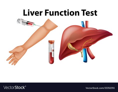 Bilirubin Levels, Prothrombin Time, Quadrants Of The Abdomen, Test Posters, Liver Function Test, Education Illustration, Education Vector, Heart Diet, Liver Function