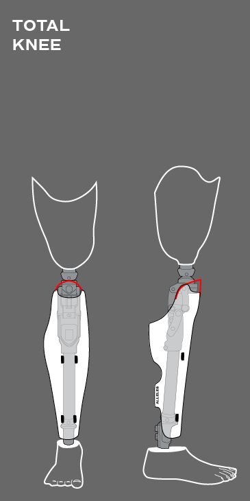 Prosthetic Leg Reference, Prosthetic Leg Concept Art, Prosthetic Leg Design, Prosthetic Leg Types, Metal Leg Prosthetic, Cute Prosthetic Leg, Knee Anatomy, Leg Prosthesis, Leg Reference