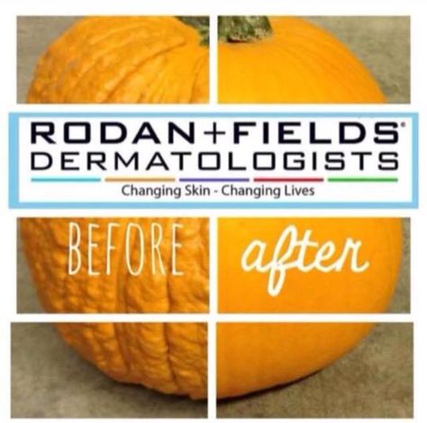 Tired of lines and wrinkles?  Rodan + Fields can help!  https://brookewilson81.myrandf.com Roden And Fields, Rodan And Fields Skincare, Rodan Fields Skin Care, Rodan And Fields Business, Rodan And Fields Redefine, Rodan And Fields Consultant, Life Changing Skincare, Love Your Skin, Independent Consultant