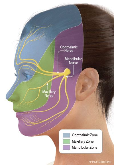 Trigeminal Neuralgia - A Nerve Disorder That Causes Facial Pain Facial Muscles Anatomy, Nerve Anatomy, Nerve Disorders, Facial Anatomy, Dental Hygiene School, Facial Nerve, Basic Anatomy And Physiology, Human Body Anatomy, Dental Center