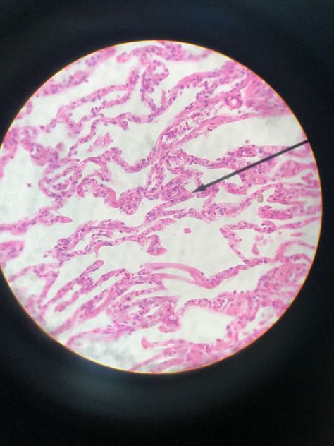 Simple squamous is flat and a singular line of cells that allows for fast and easy diffusion and filtration. In this tissue bronchitis can occur Histology Slides, Respiratory, Biology