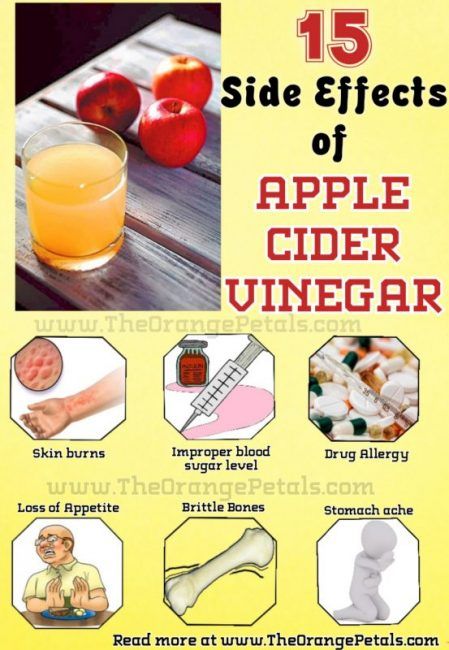 Side Effects of Apple Cider Vinegar Apple Cider Vinegar Bath, Apple Cider Vinegar Face Mask, Drinking Apple Cider Vinegar, Apple Cider Vinegar Acne, Apple Cider Vinegar For Skin, Apple Cider Vinegar For Hair, Apple Cider Vinegar Drink, Skin Burns, Stomach Ache