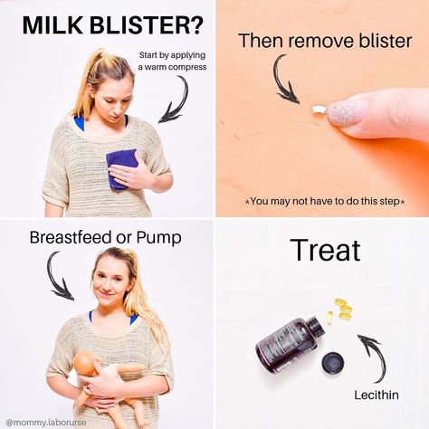 I used to get these suckers ALL the dang time! ⁣⁣ .⁣⁣ Has anyone suffered from milk blebs/blisters?⁣⁣ .⁣⁣ Here’s what they are, and how to… Milk Blister, Labor Nurse, Warm Compress, Labor Delivery, Labor, Milk, How To Apply, On Instagram, Instagram