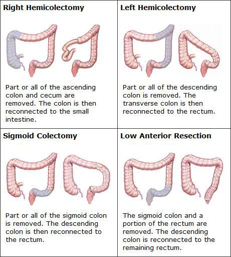 Nursing Terminology, Gastrointestinal Nursing, Surgical Assistant, Surgical Oncology, Wound Care Nursing, Operating Theatre, Nurse Skills, Basic Anatomy And Physiology, Nurse Study Notes