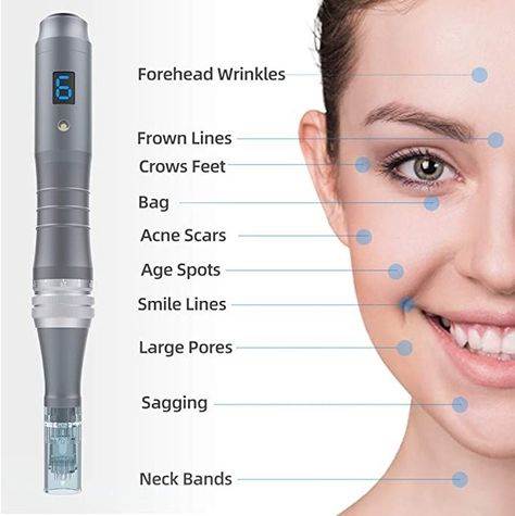 Microneedling Pen, Derma Rolling, Micro Needle Roller, Derma Pen, Derma Roller, Scar Removal, Acne Spots, Skin Discoloration, Skin Care Kit