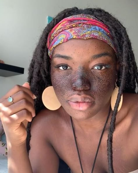 Black Girls With Freckles, Black Freckles, People With Freckles, Women With Freckles, Rare Features, Beautiful Freckles, Freckles Girl, Unique Faces, Milk Honey