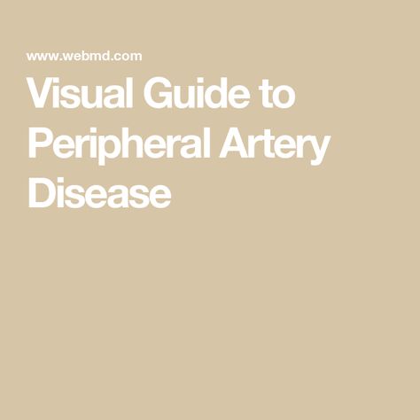 Visual Guide to Peripheral Artery Disease Peripheral Artery, Coronary Artery, Venous Insufficiency, Clogged Arteries, Coronary Arteries, Healthy Lifestyle Habits, Leg Pain, Cardiovascular Disease, Improve Health