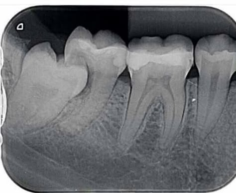 Dental Xrays, Dentistry Quotes, Happy Dental, Teeth Aesthetic, Dental Facts, Book Of Kells, Dental Humor, Wisdom Teeth, Oral Health Care