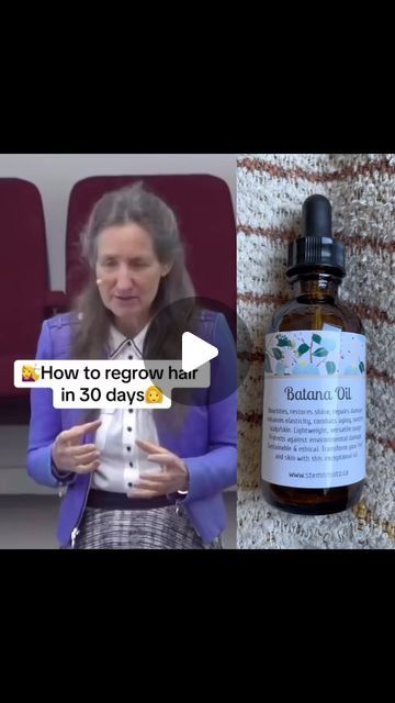 How To Use Batana Oil For Hair Growth, Batana Oil Hair, Best Hair Vitamins For Hair Growth, Batana Oil Hair Growth, Batana Oil Before And After, Batana Oil Benefits, Hair Strengthening And Growth, Hairline Growth, Castor Oil Benefits Skin