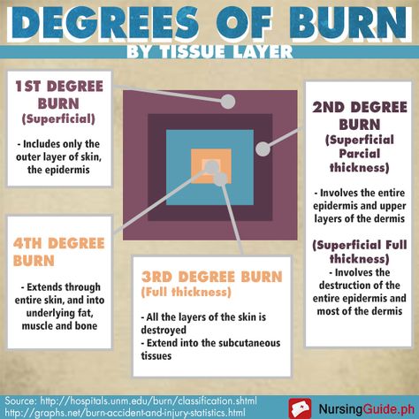 Burns Nursing, Types Of Burns, Ahg Badge, Burn Care, Paramedic School, Nursing Information, Nursing Fun, New Grad Nurse, Nurse Study Notes