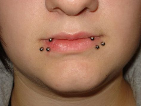 Shark Bites Shark Piercing, Raccoon Bites Piercing, Shark Bites Piercing, Ink Poisoning, Spider Bites, Cool Piercings, Shark Bites, Body Modification, Body Modifications