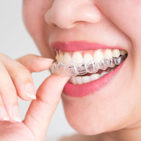 Made from smooth, comfortable plastic, Invisalign aligners fit snugly over your teeth. Plus, they’re removable, making it easy to eat, drink, brush, and floss without any restrictions.  ☎️ 732-636-2828 . . #galkinorthodontics #orthodontist #invisalign #greatsmilesbygalkin #clearaligners Invisalign Aligners, Invisalign Braces, Dental Aesthetics, Traditional Braces, Invisible Braces, Orthodontics Braces, Tooth Replacement, Teeth Straightening, Metal Braces