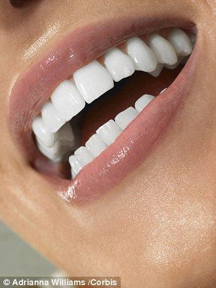 Veneers Teeth, Dental Implants Cost, Beautiful Teeth, Loose Tooth, Perfect Teeth, Teeth Implants, Dental Bridge, Smile Teeth, Natural Teeth Whitening