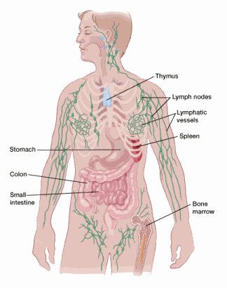 If You Have Non-Hodgkin Lymphoma Lymph Vessels, Lymph System, Lymph Nodes, Disease, Human