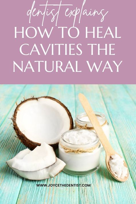 I have such a big cavity and was excited to read it can be reversed naturally! Cavity Remedy, Natural Remedies For Cavities, Reverse Cavities, Tooth Cavity, Tooth Decay Remedies, Remedies For Tooth Ache, Heal Cavities, Dental Health Care, Dental Cavities