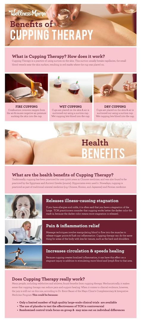 The benefits of cupping therapy- and does it actually work What Is Cupping Therapy, Wet Cupping, Benefits Of Cupping, Hijama Cupping, Massage Cupping, Fire Cupping, Acupuncture Benefits, Cupping Massage, Wellness Mama