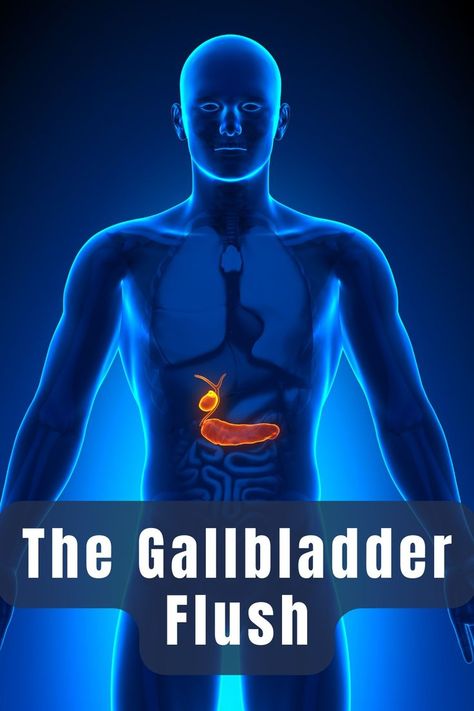 The Gallbladder Flush and Liver Detox Protocol Gall Bladder Flush, Gallbladder Flush Recipe, Heal Gallbladder, Gallbladder Friendly Recipes, Gallbladder Attack Symptoms, Gallbladder Symptoms, Gallstone Diet, Liver And Gallbladder Cleanse, Gallbladder Health