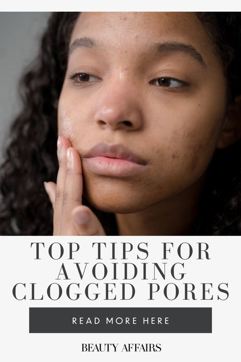 Getting down to the cause of clogged pores can prevent lots of breakouts. This skincare guide explains the most common causes of clogged pores and bumpy skin, plus explains the best way to get clearer skin. Congested Skin Clogged Pores, Rebeca Jones, Sebaceous Filaments, Damaged Skin Barrier, Skincare Guide, Skincare Habits, Pore Strips, Skincare Advice, Congested Skin