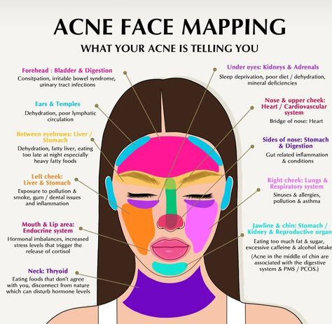 Gesicht Mapping, Acne Face Map, Face Map, Sinus Allergies, Face Mapping Acne, Face Mapping, Skin Care Basics, Skin Advice, Glow Ups