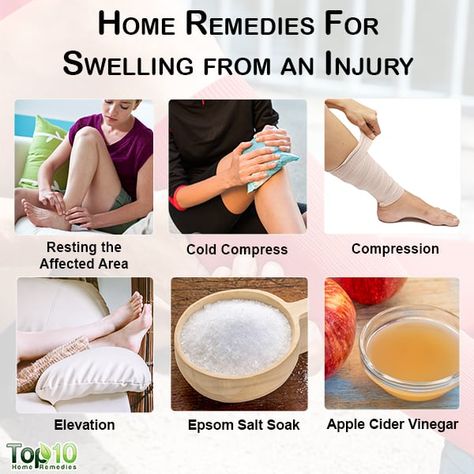 home remedies for swelling from an injury Swelling Remedies, Swollen Hands, Knee Pain Remedy, Swollen Knee, Healthy Spine, Top 10 Home Remedies, Reduce Swelling, Shoulder Injuries, Massage Techniques