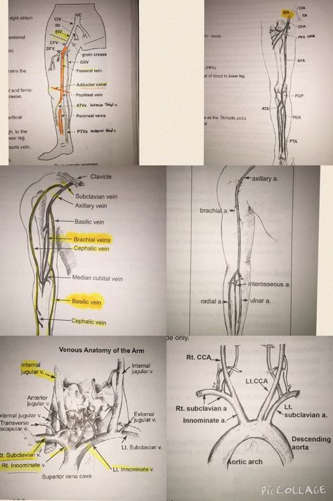 Diagnostic Medical Sonography Student, Ultrasound School, Cardiac Sonography, Sonography Student, Vascular Ultrasound, Ultrasound Sonography, Medical Ultrasound, Ultrasound Technician, Diagnostic Medical Sonography