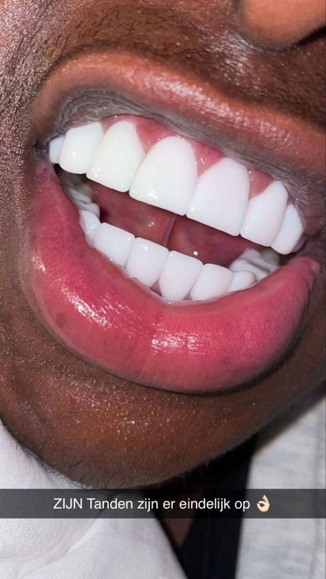 #WhatDoesOralCareMeanToYou Teeth Aesthetic, Pretty Teeth, Strong Teeth, Veneers Teeth, Mens Nails, Straight Teeth, Perfect Teeth, Nice Teeth, Stronger Teeth