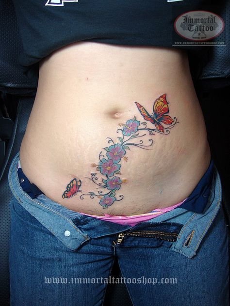 tattoos to cover scars on stomach | Frank and decided to cover up her CS scar done in Immortal Tattoo ... Abdominal Scar Tattoos Women, Belly Scars Cover Up Tattoo, Vertical Stomach Scar Tattoo Cover Up, Stomach Scar Tattoo Cover Up, Immortal Tattoo, Lower Stomach Tattoos For Women, Flower Tats, Belly Button Tattoos, Tummy Tattoo