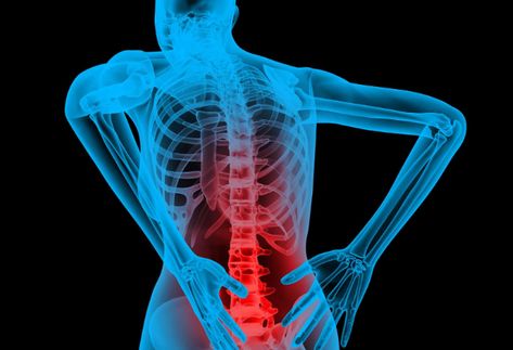 Don't get lumbar fusion in your L5 S1 region in your spine. Use Regenexx stem cell treatments instead! Causes Of Back Pain, Upper Back Pain, Headline News, Lower Back Pain, Nerve Pain, Low Back Pain, Back Pain Relief, Chronic Fatigue, Sciatica