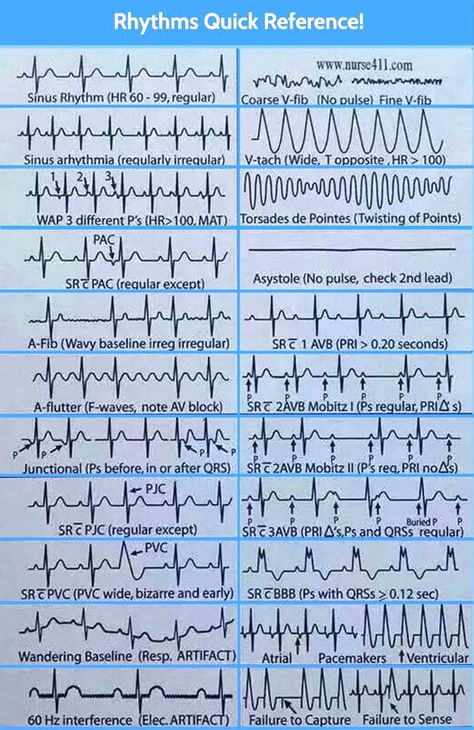 MedicTests.com on Twitter: "https://t.co/Mp5VgxDSog" / Twitter Emt Paramedic Aesthetic, Paramedic Aesthetic, Nurse Knowledge, Paramedic Study, Cardiac Rehab, Emt Study, Er Tech, Psychotropic Medications, Ekg Interpretation