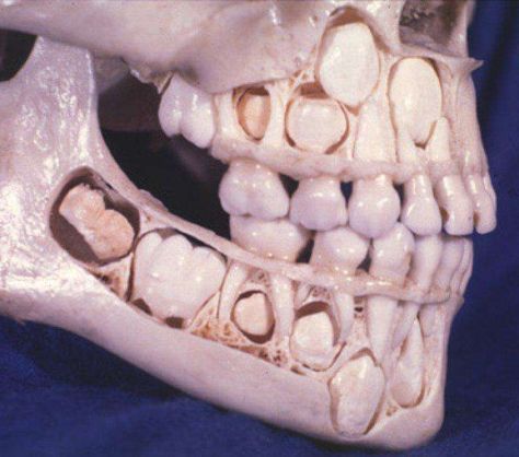 50 Incredible Pictures That Might Teach You Something Childs Skull, Human Science, Sweaty Palms, Dental Fun, Kids Teeth, Unusual Facts, Bad Image, Baby Teeth, Make You Feel