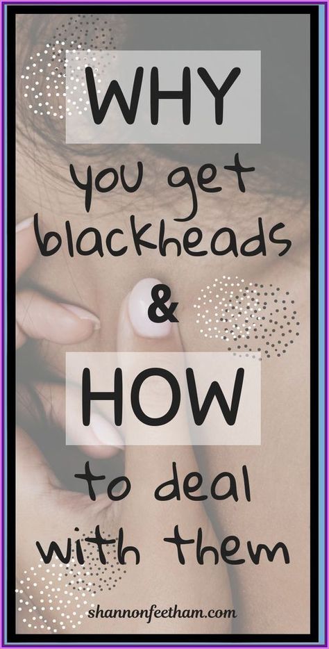 Get Rid of Blackheads For Good Rid Of Blackheads, Black Heads, Brittle Nails, Word Online, School Communication, Creating A Newsletter, Get Rid Of Blackheads, Health Planner, Fitness Advice