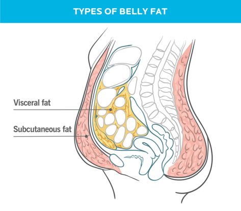 How To Lose Belly Fat, According to Science | Precision Nutrition How To Get Rid Of A Pot Belly, Losing Visceral Fat, Lower Stomach Fat, Flabby Belly, Sanne Vloet, Get Back In Shape, Belly Fat Reduction, Loose Belly, Precision Nutrition