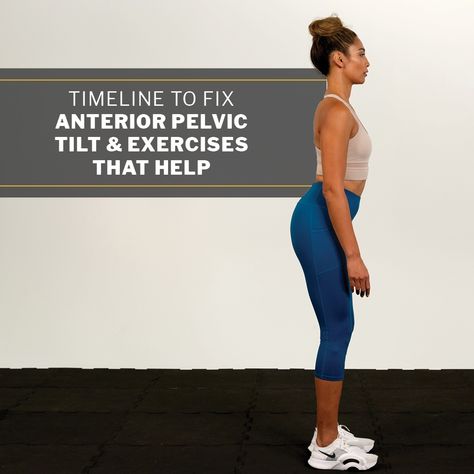 If you have an anterior pelvic tilt, you may be wondering how long it takes to fix it. Learn what the research says and a few exercises that can help. Exercises To Fix Anterior Pelvic Tilt, How To Correct Anterior Pelvic Tilt, Exercises For Pelvic Tilt, Stretches For Anterior Pelvic Tilt, How To Fix A Tilted Pelvis, Fixing Anterior Pelvic Tilt, Interior Pelvic Tilt Exercises, Pelvic Lift Exercise, Forward Pelvic Tilt