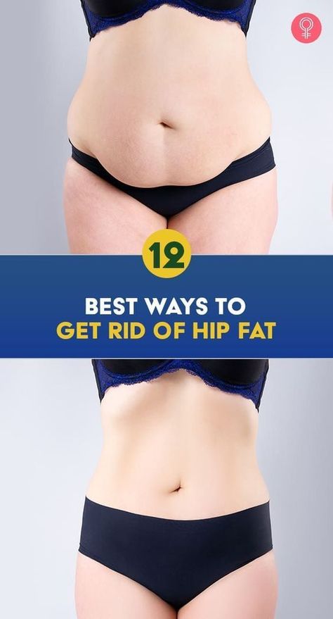 12 Best Ways To Get Rid Of Hip Fat: Firm and round buttocks are not only aesthetically pleasing but also improve posture and support the core. Keep reading to learn some ways to shed the excess fat from your hips and prevent it from sagging. Reduce Hips, Slim Hips, Reduce Body Fat, Diet Vegetarian, Improve Posture, Burn Belly Fat, Lose Body Fat, Fat Burner, Belly Fat Loss