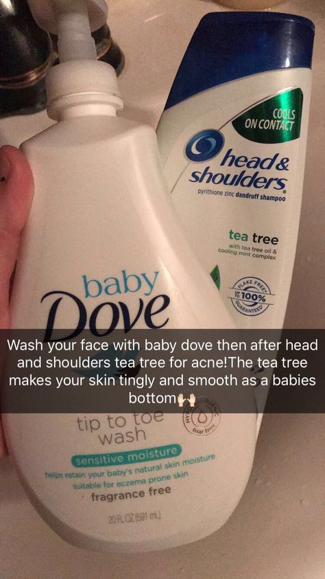 Is Dove Soap Good For Face, Dove Soap For Face Acne, Head And Shoulders For Acne, Shoulder Acne, Acne Prone Skin Care Routine, Tea Tree For Acne, Acne Routine, Head And Shoulders Shampoo, Dove Soap