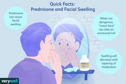 Face Swelling Causes, Moon Face Swelling, Prednisone Moon Face, Face Swelling, Facial Swelling, Journal Dump, Effective Management, Chest Congestion, Becoming A Better You