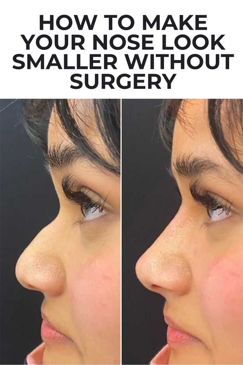 How To Remove Specs Marks On Nose, How To Have A Smaller Nose, How To Make Nose Smaller, How To Make Your Nose Smaller, Make Nose Smaller, Smaller Nose, Nose Reshaping, Small Nose, Face Skin Care Routine