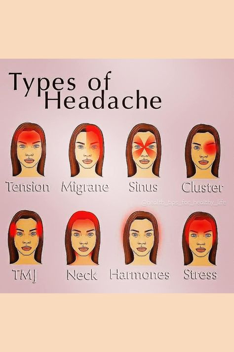 TYPES OF HEADACHE Reasons For Headaches, Types Of Headache, Headache Chart, Different Types Of Headaches, Headache Types, Summer Health, Blood Sugar Diet, Health And Fitness Magazine, Healthy Diet Tips