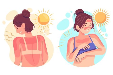 Different people with a sunburn | Premium Vector #Freepik #vector #sunburn #summer-collection #summer-time #summer-design How To Treat Sunburn, Sunburn Skin, Different People, Instagram Editing, Cartoon Images, Premium Vector, Graphic Resources, Google Images, Image Search